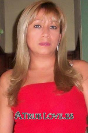 142201 - Sandra Janeth Edad: 51 - Colombia